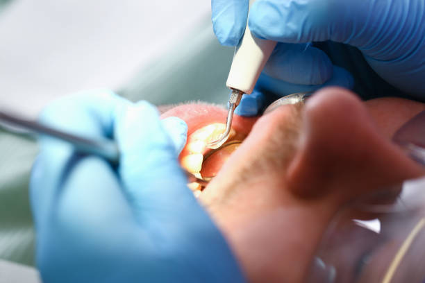 Best Emergency Root Canal Therapy in Cameron Park, TX